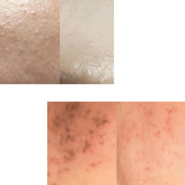 IMPIEL Azulene Cica Soothing Ampoule 30ml