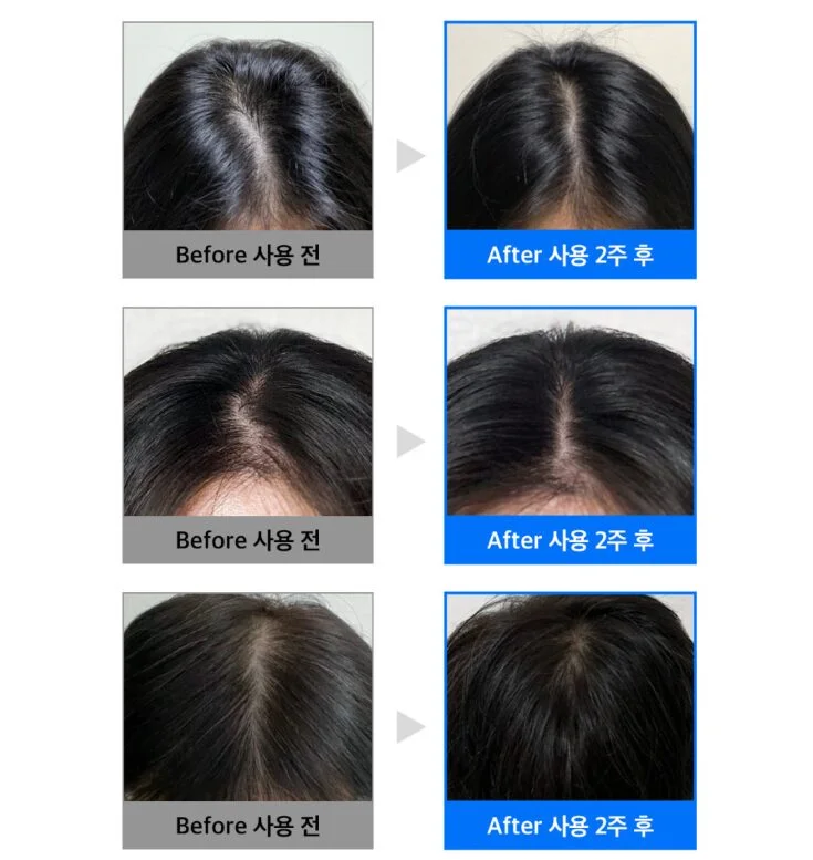 Refilled Cytokine Hair Tonic Booster Pro 70ml Hair Loss Ampoule - Image 2
