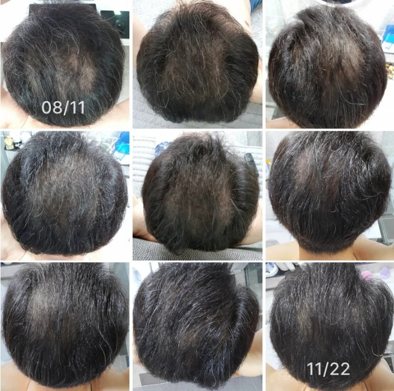CELL RETURN Hair Alpha Ray S Scalp Massager - Image 3