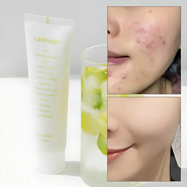 ELIMERE Cabbage Acne Foam Cleanser 120ml