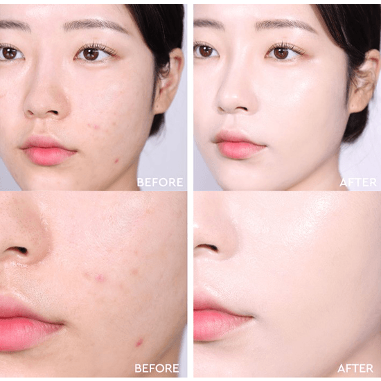 AGE20's Noble Glow Cover Cushion with Refill SPF 40 PA+++ - EmpressKorea