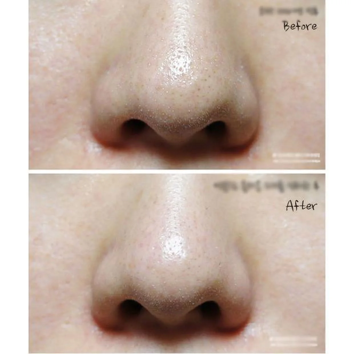 Ciracle Blackhead Off Cotton Mask 20EA*5ml - EmpressKorea