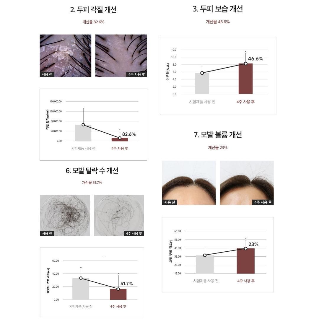 DERMA FACTORY Anti Hair Loss Shampoo 300ml *2pcs Beer Brewer's Yeast 41% Caffeine 1% Natural Active Ingredients Scalp Hair Care - EmpressKorea