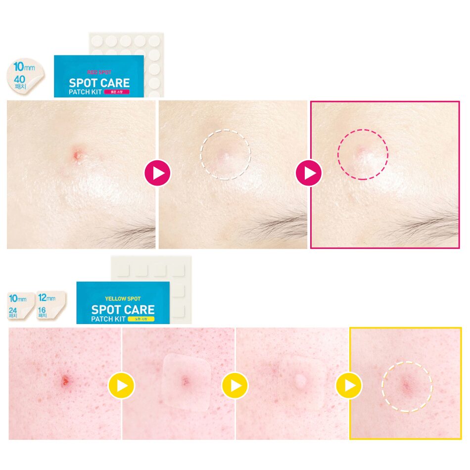HATHERINE Spot Care Patch Kit (2 Types Spot Patch Duo) 80 Patches - EmpressKorea