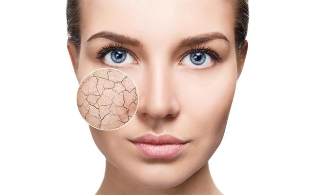 Say-Goodbye-To-Dry-Skin-Try-These-Home-Remedies_f118011d-a03b-49d4-a40e-c7bb524b81db