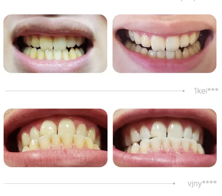 BYE YELLOW Vivid Whitening Toothpaste 120g