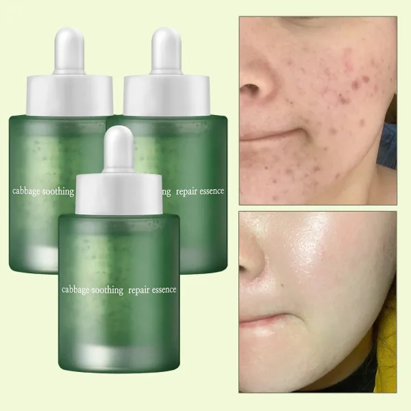 ELIMERE Cabbage Soothing Repair Essence 50ml