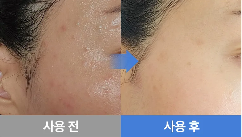 Dr.deep Clinical Texture Turnover TT Spot Cream 40ml - Renewal - Image 3