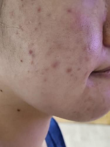 Customer review photo