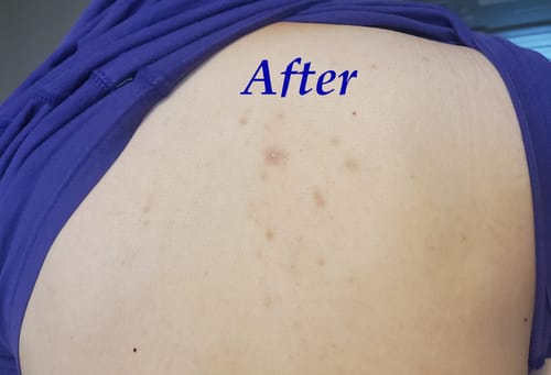 Customer review photo