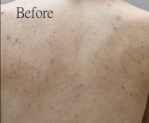 Customer review photo