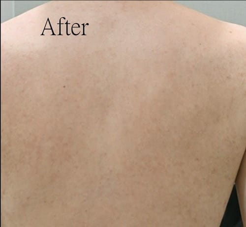 Customer review photo