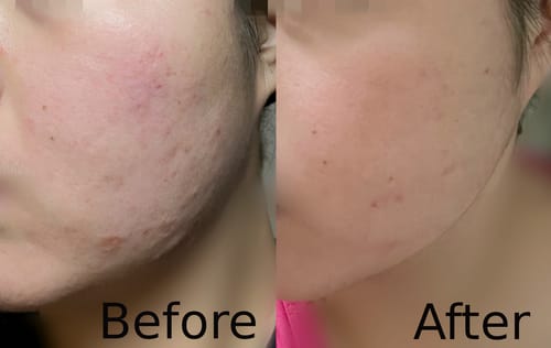Customer review photo
