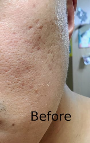 Customer review photo