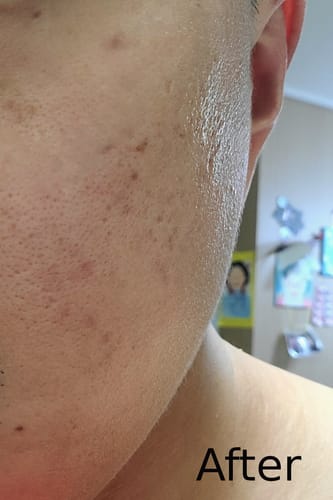 Customer review photo