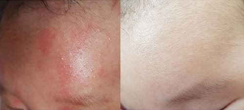 Customer review photo