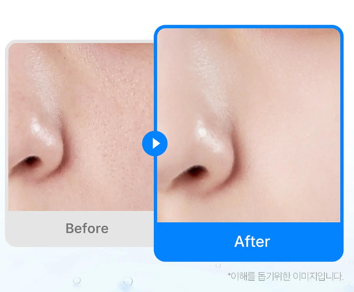 medicube Zero Pore Pad 155g 70pads