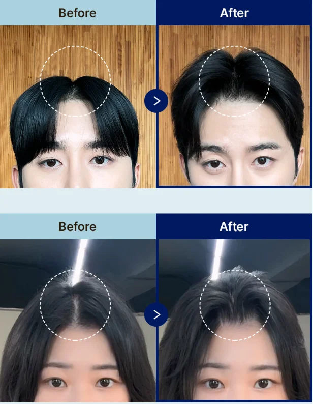 DASHU Daily Volume Pick Forehead Root Volume - Cosmetics - View 1