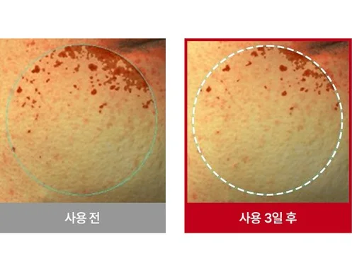 RAVIEL Acerola Dark Spot Blemish Care Cream 80ml - Facial Milla/Flat Warts Improve - Cosmetics - View 1