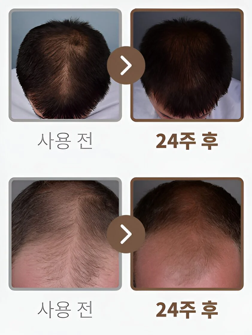 Yashuv Hair Loss Relief Murmury Booster 100ml - Image 2