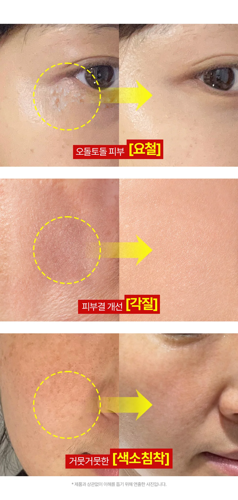 Mommy Care Yulmu Cream 50g – Facial Milla / Flat Warts Improve - Image 10