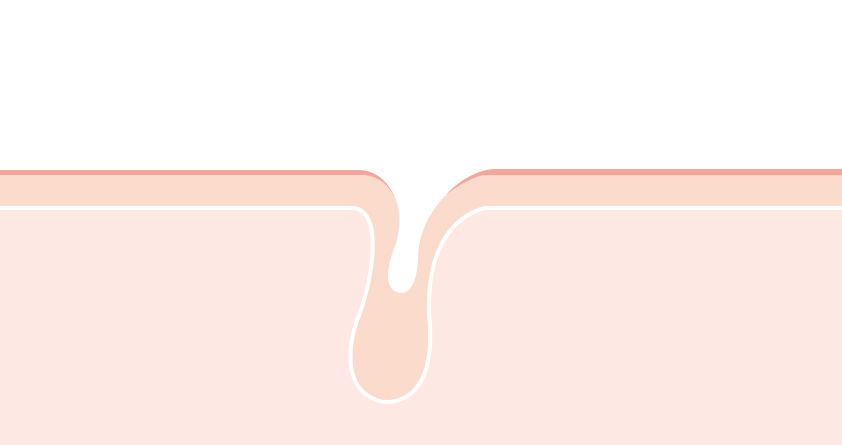 Dr.Ceuracle 5α CONTROL CLEARING CLEANSING FOAM 200ml empresskorea Microbubble Cleansing Foam: Sebum Care and Skin Hydration D...