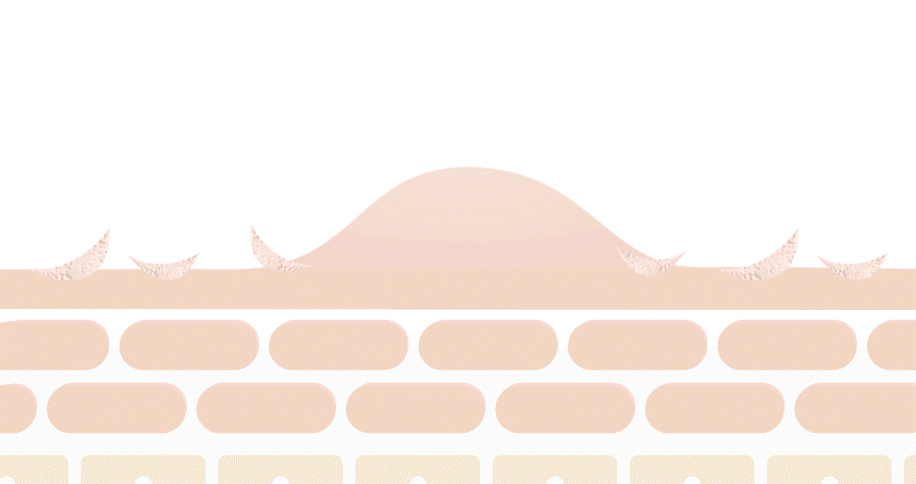 Dr.Ceuracle AC Cure Solution Green Two 50ml empresskorea Experience Rapid and Effective Spot Care with AC Cure Solution Green...