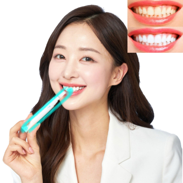 [for sale at the dental office] Smile Balm self-teeth whitening agent with guaranteed effectiveness - EmpressKorea