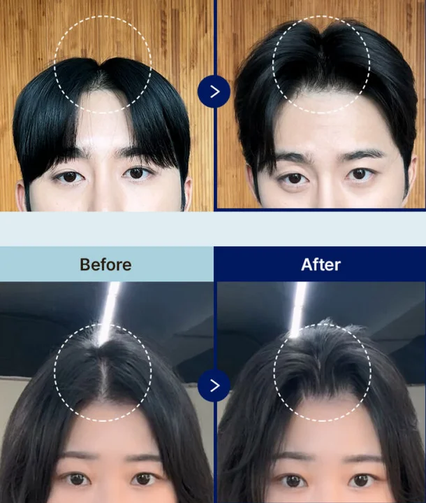 캡처