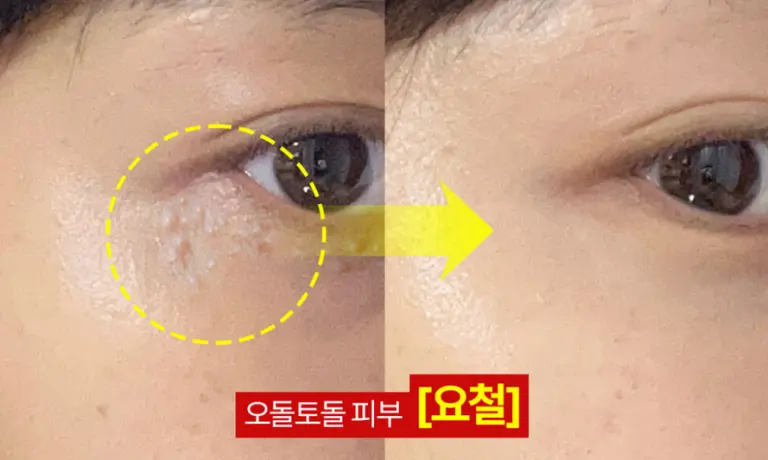 캡처00