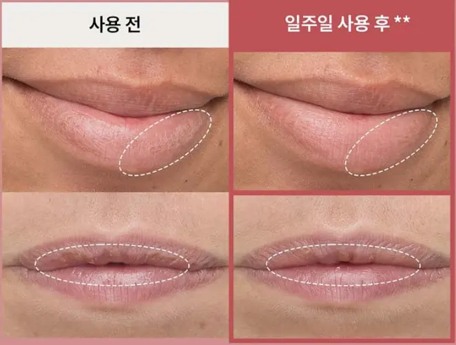 LANEIGE Donut Lip Serum Strawberry 12g + Sugar12g Set