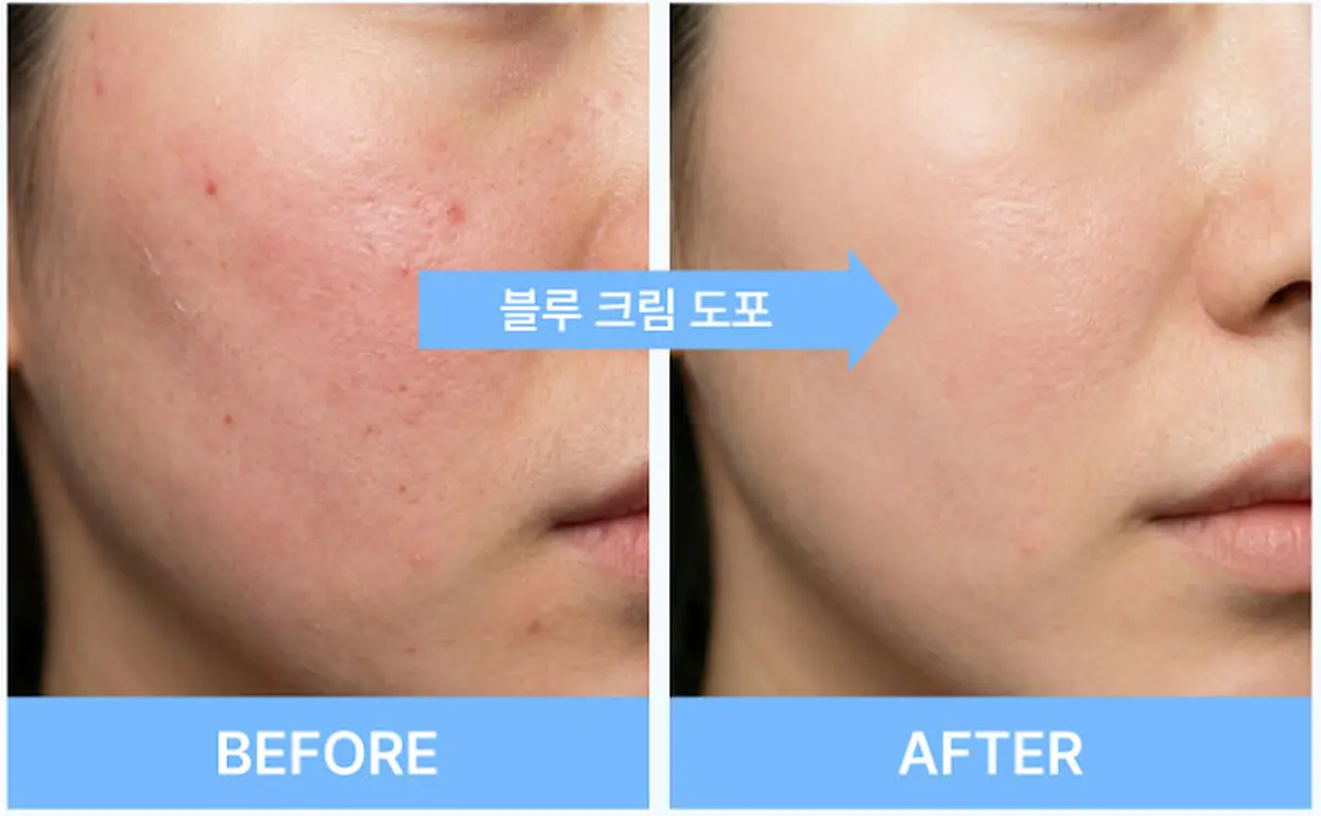 Refinelle Azure Cream 40ml