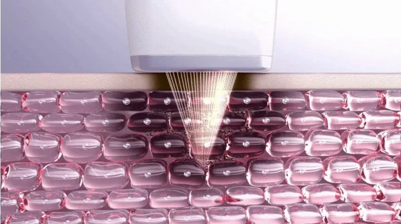 Melashot Technology