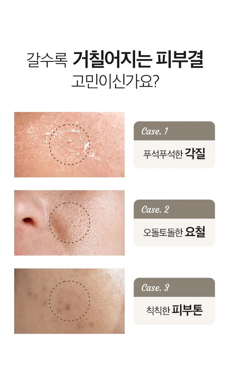 MEDIYUL Yulmu Pack
