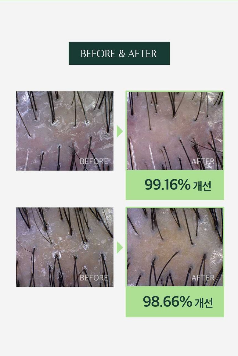 Dr. Seed Scalp Water Scaler Detail