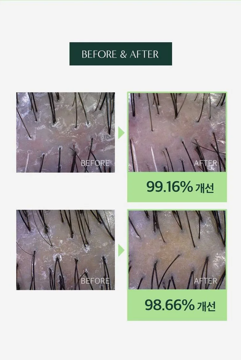 Dr. Seed Scalp Water Scaler Detail