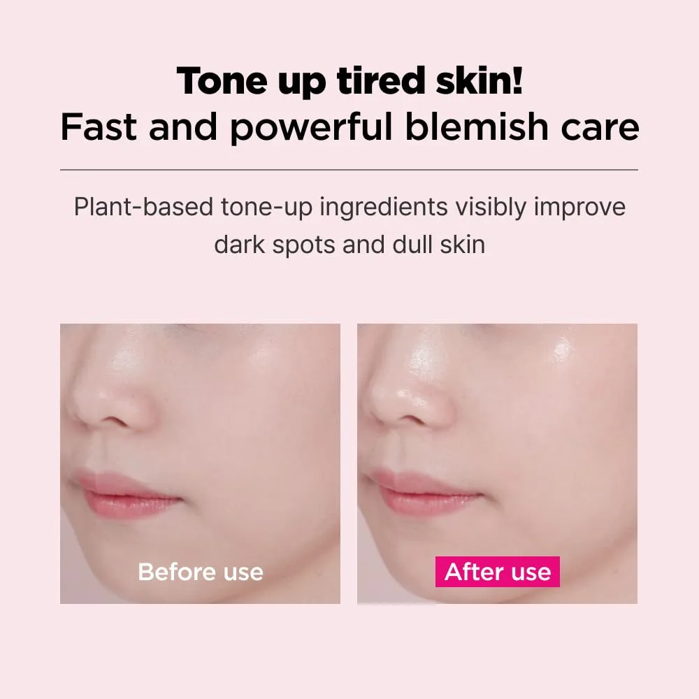 ISOI Blemish Care Mask - 1 Box of 10 Sheets - Image 4