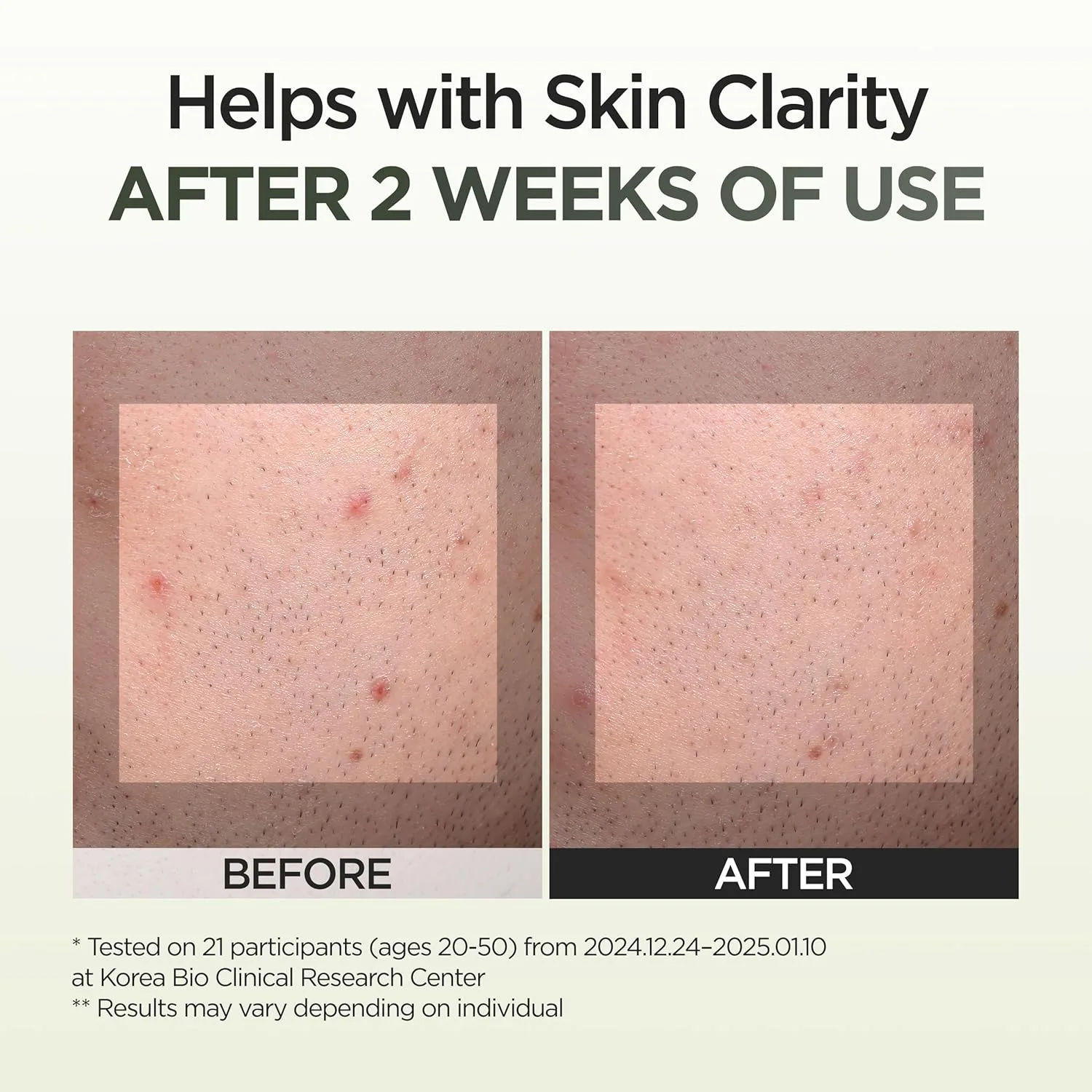 P.CALM 9 Seaweed Spot Correcting Serum