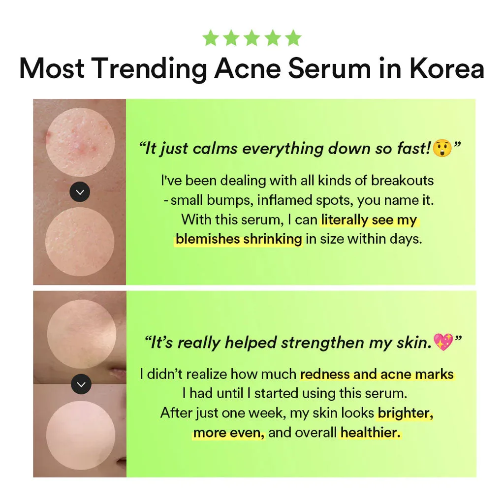 Abib Heartleaf TECA Capsule Serum Calming Drop 50ml - Image 3