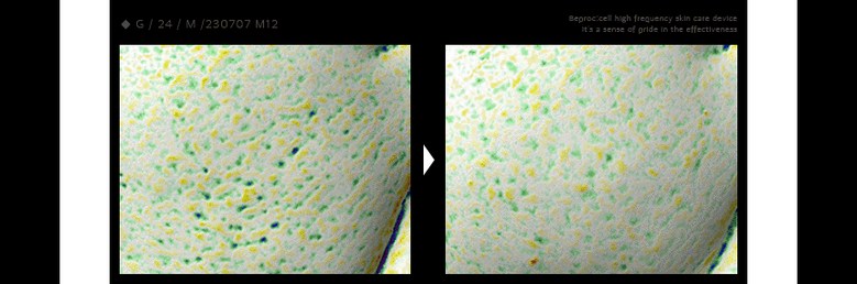 bepro:cell High Frequency Device Detail 01