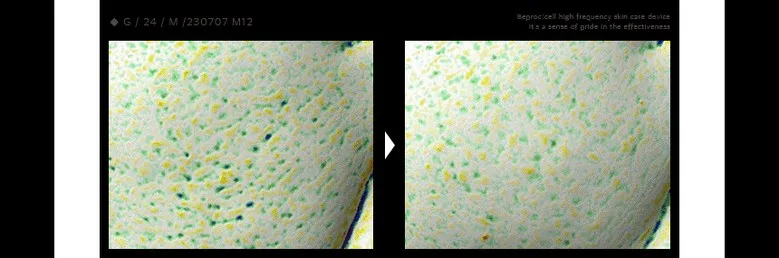 bepro:cell High Frequency Device Detail 01