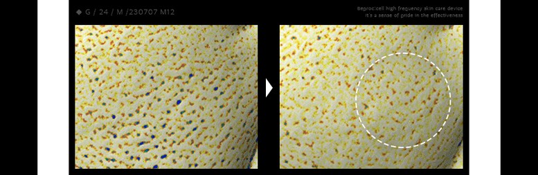 bepro:cell High Frequency Device Detail 03