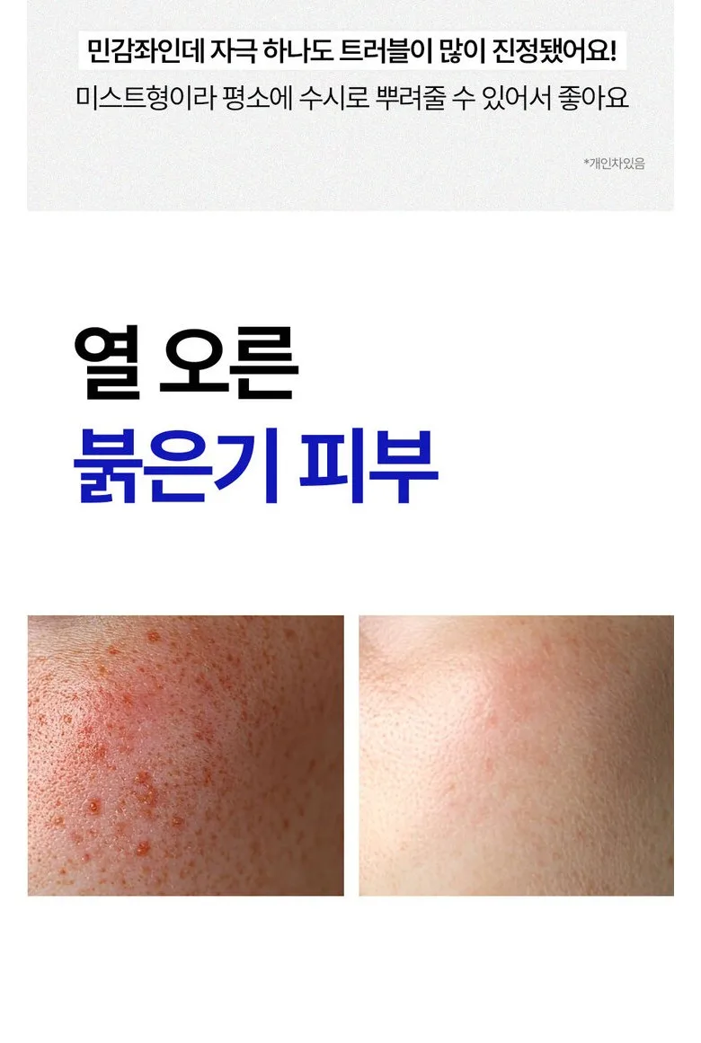 PIBUMI Nano Cica Mist Detail