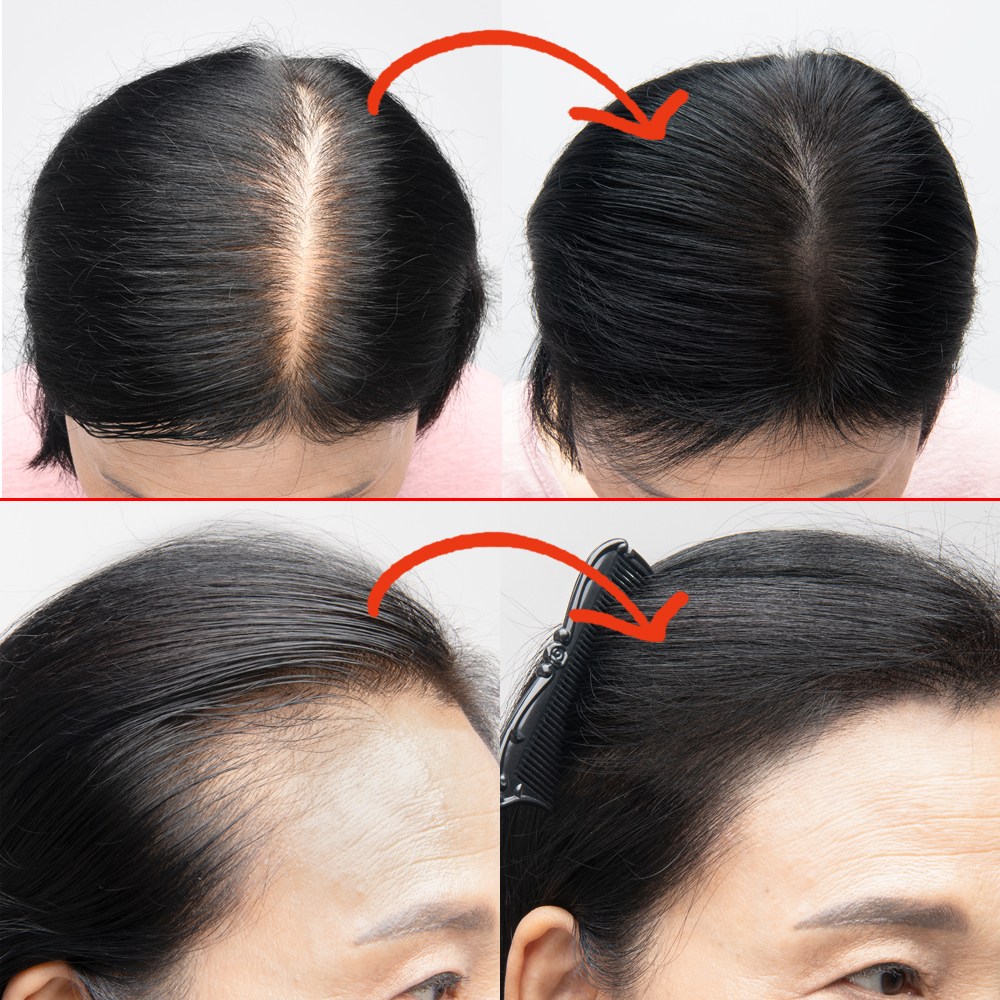 Novier Scalp Tattoo Tint - Before After Results