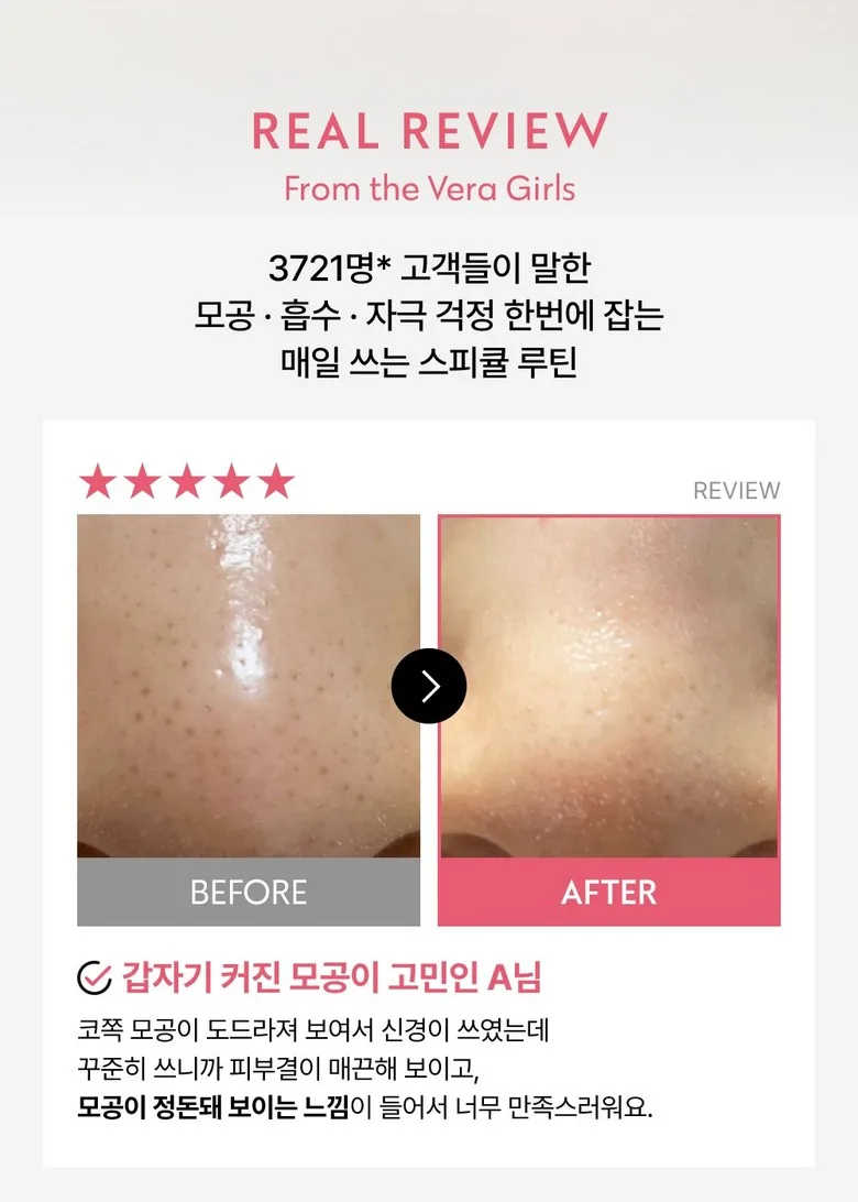 VERAMORE Pore Tightening Spicule 300 Ampoule Detail