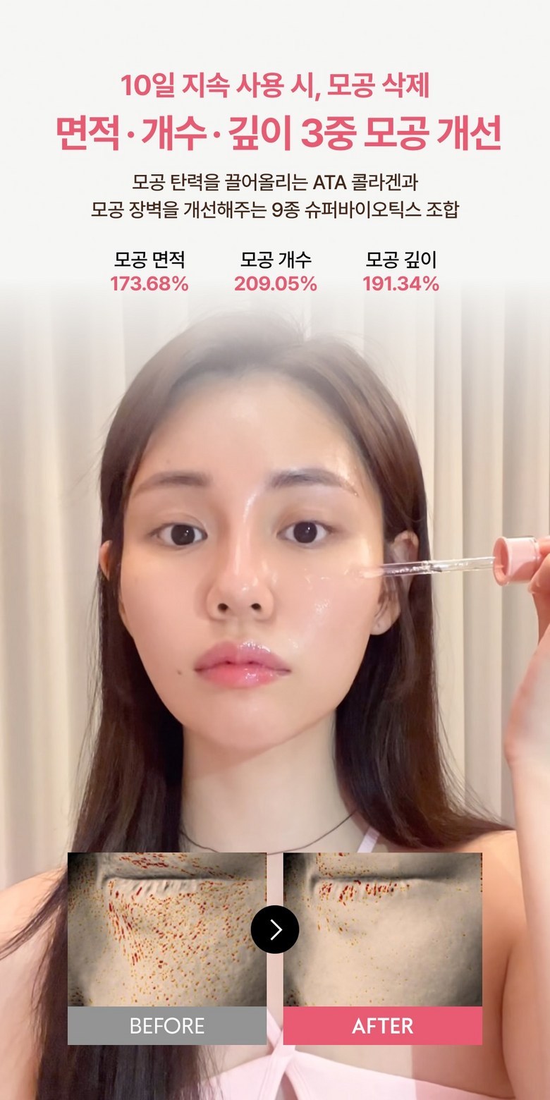 VERAMORE Pore Tightening Spicule 300 Ampoule Detail