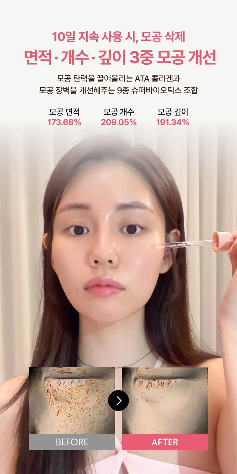 VERAMORE Pore Tightening Spicule 300 Ampoule Detail