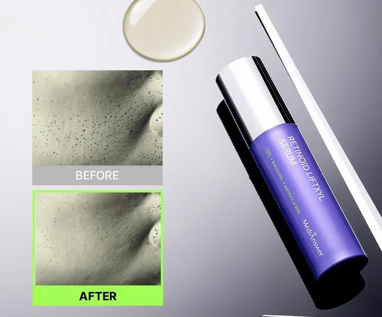 MEDIANSWER Retinoid Liftsil Serum 30ml