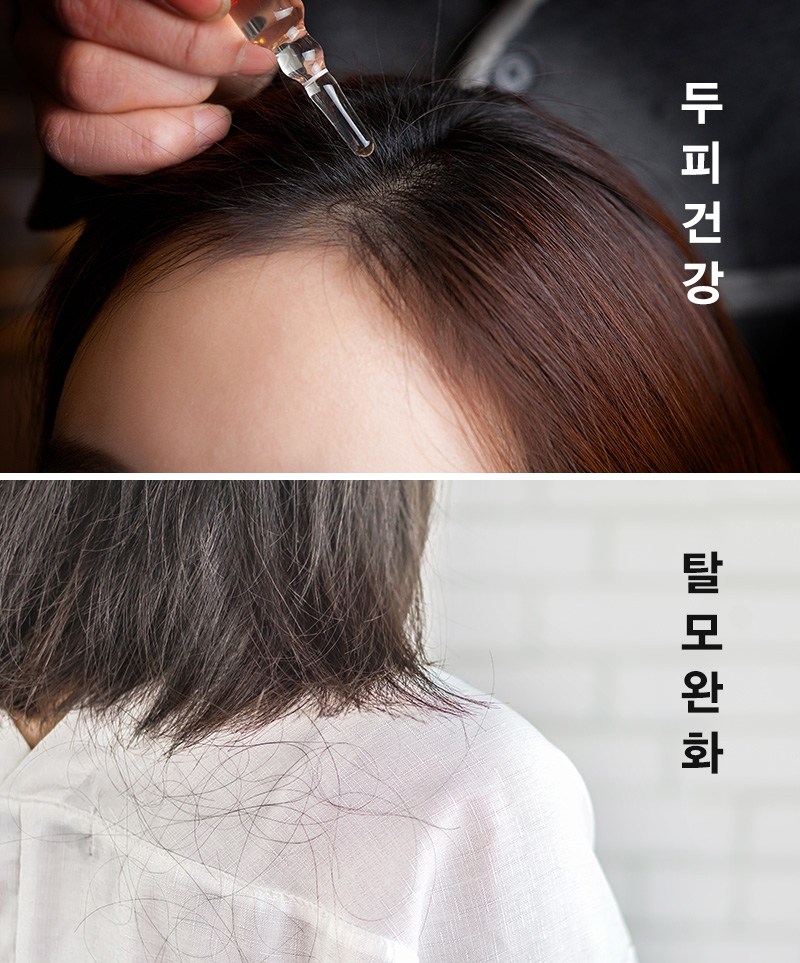 Scalp Health Hair Loss Relief