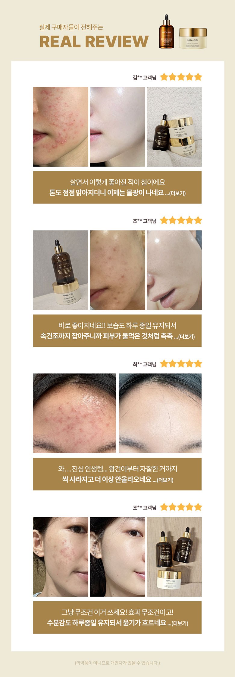 LORY CHEL Glorious Set Real Reviews